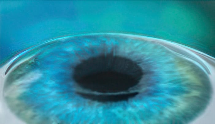 LASIK step 4